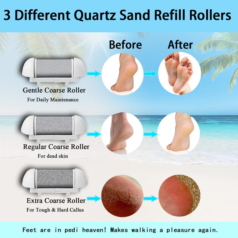Callus Remover for Feet Electric Foot File, 13-in-1 Professional Pedicure Tools Foot Care Kit, Foot Scrubber Pedi for Hard Cracked Dry Dead Skin, 3 Rollers, 2 Speed, Battery Display (White&Grey) White&grey - BeesActive Australia