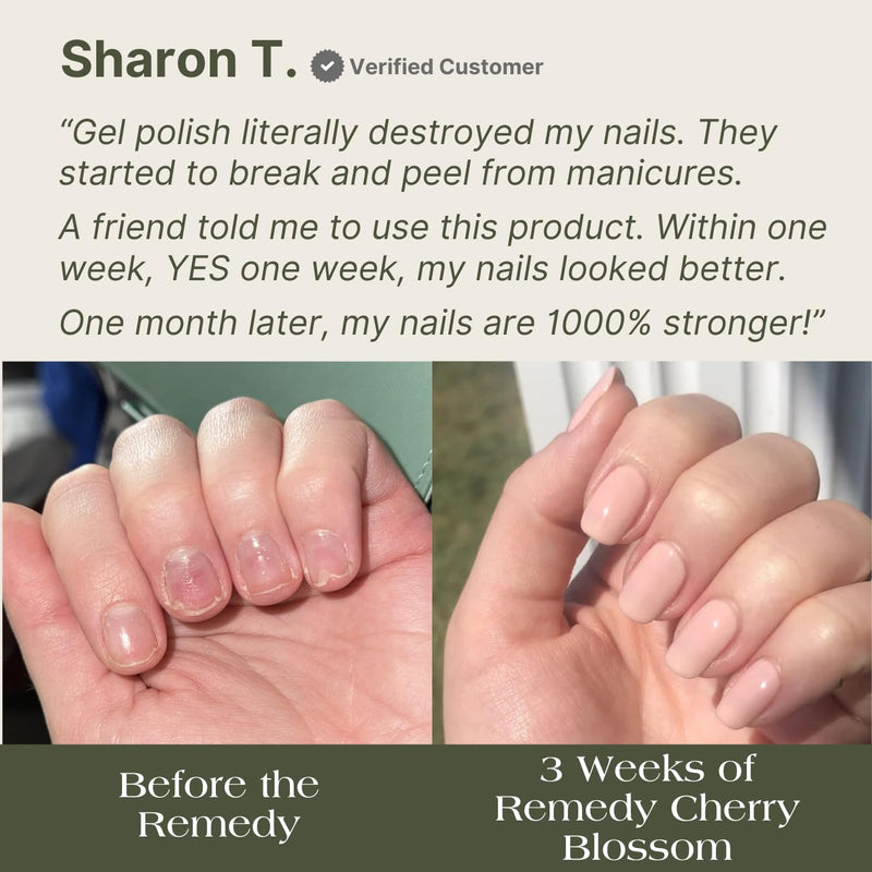 Botanist The Remedy | Nail Strengthening Polish | Repairs & Hardens Nails Damaged from Acrylics, Dip & Gel Manicures | Non-Toxic, 84% Plant Based, 21-Free & Vegan (Blush Dahlia) Blush Dahlia - BeesActive Australia