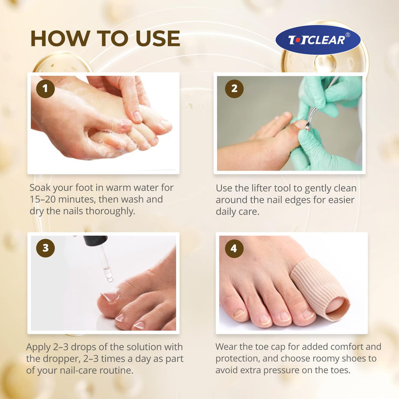 Ingrown Toenail Relief: Ingrown Toenail Drops - Ingrown Toenail Removal Kit - Toe Ingrown Nail - In Grown Toenail - Ingrown Toenail Tool - Easy Effective Solution for Ingrown Toenails - 2 Pack 1 Fl Oz (Pack of 2)