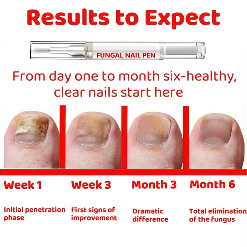 Fungal Nail Pen with Allicin & 25% Undecylenic Acid, Nail Repair Pen | Extra Strength Nail | Toenail & Fingernail Care 2pcs - BeesActive Australia