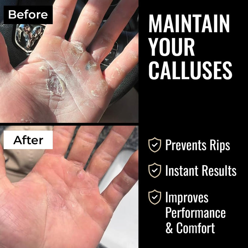 SandBar Callus Remover File for Hands - Durable Aluminum Tool for Callus Care and Dead Skin Removal - Includes Nourishing Salve - Ideal for Athletes, Climbers, and Gym Enthusiasts Flat Black - BeesActive Australia