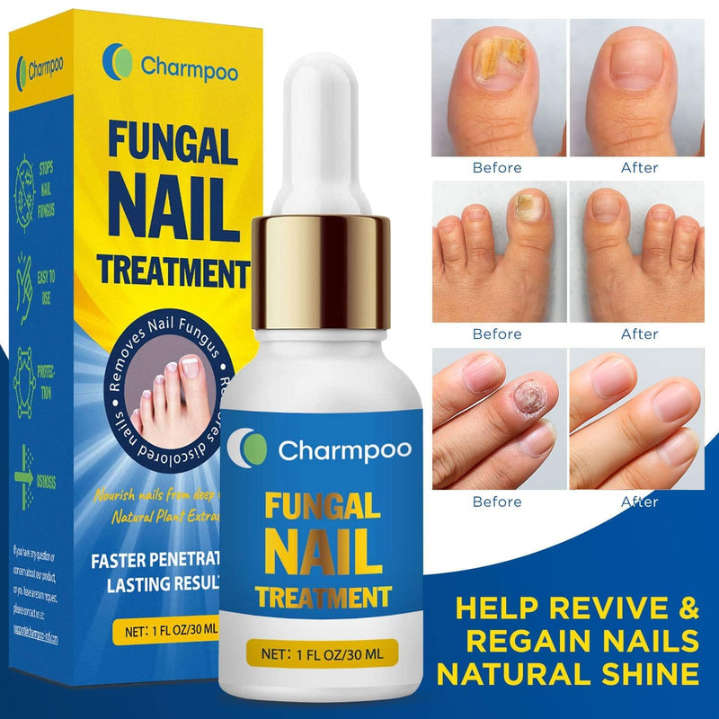 Toenail Fungus Treatment Extra Strength: 30ml(Pack of 2) Nail Cuticle Care Serum – Infused with Botanical Herbal Extracts for Clear Healthy-Looking Nails Lightweight Daily Nail & Toe Care
