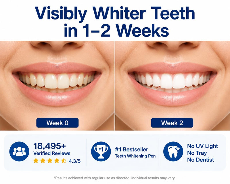VieBeauti Teeth Whitening Pen Kit, 35% Carbamide Peroxide Gel, 5 Pack Mint