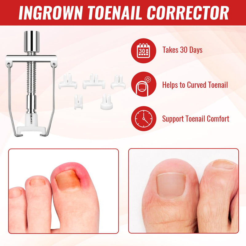 Ingrown Toenail Removal Kit, Ingrown Toenail Tool Kit with Ingrown Toenail Corrector, Ingrown Toenail Drops, Corrector Patch, Toenail Clipper, Nail File Lifter Tools - BeesActive Australia