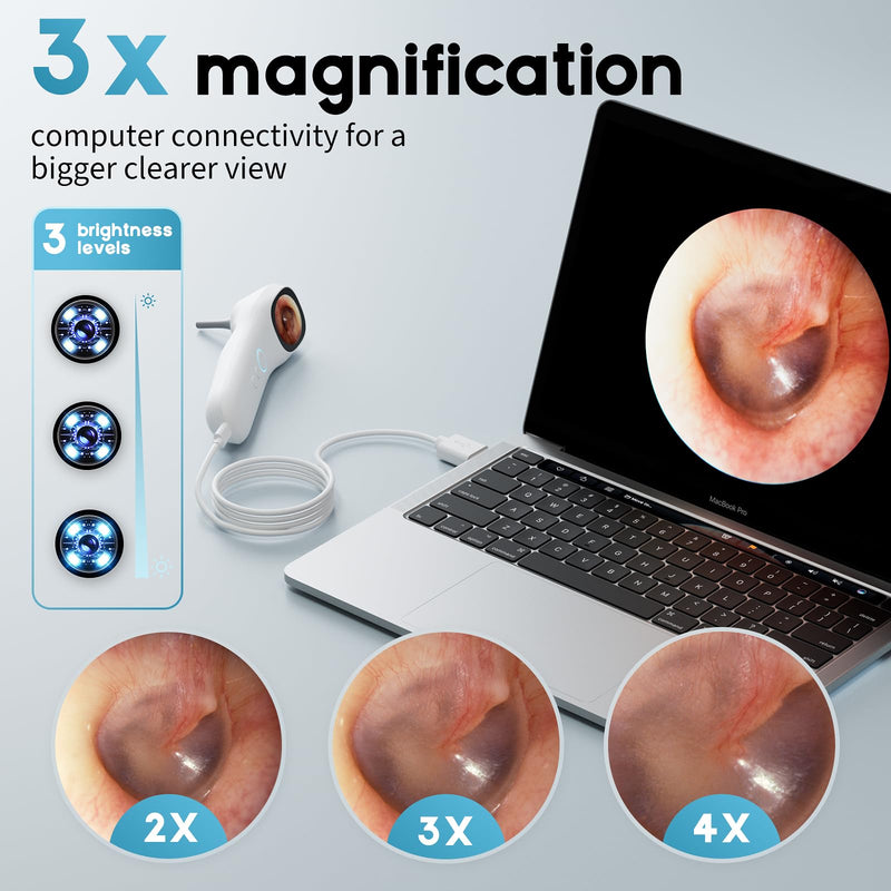 Otoscope Ear Camera with 1.21” Screen, 1080P Ear Scope with 4 LED Lights, Otoscope Camera for Adults Kids, Support Photo & Video, Type-C Charging with Computers, Baby Essentials, Home Medical Simplified – White - BeesActive Australia