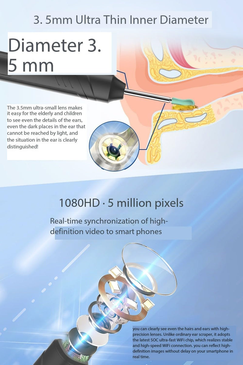 Ear Wax Removal, 1080P FHD Wireless Otoscope Earwax Removal Tool, WiFi Ear Endoscope with LED Lights, 3mm Mini Visual Ear Inspection Camera Silicone Ear Pick for Adults Kids Pets (Black) - BeesActive Australia