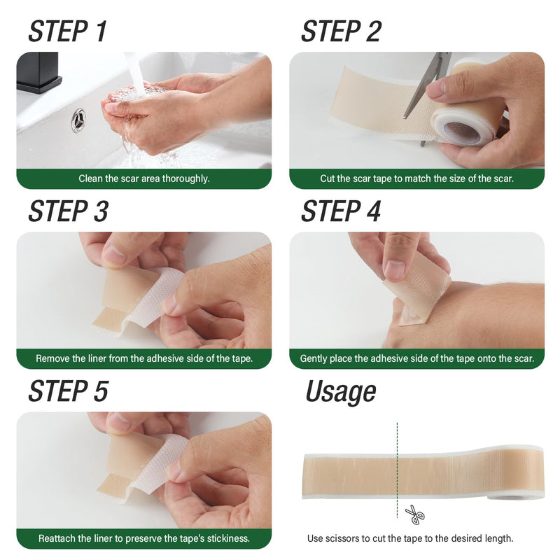 Silicone Scar Sheets,Silicone Scar Tape,Silicone Sheets For Scars,Scar Tape For Surgical Scars,Keloid Bump Removal,Scar Removal For Surgical(1.6"x 60" Roll-1.5M) - BeesActive Australia