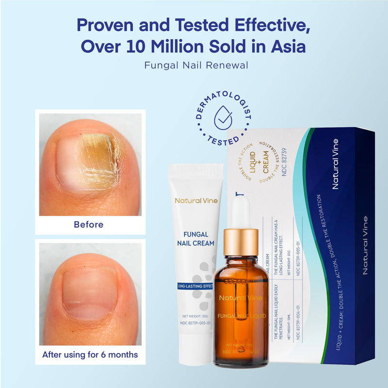 Natural Vine Toenail Fungus Treatment: Fungus Nail Treatment Liquid 15mL and Anti-fungal Nail Repair Cream 20g for Toenail and Fingernails - Extra Strength with Plant Extract Ingredients