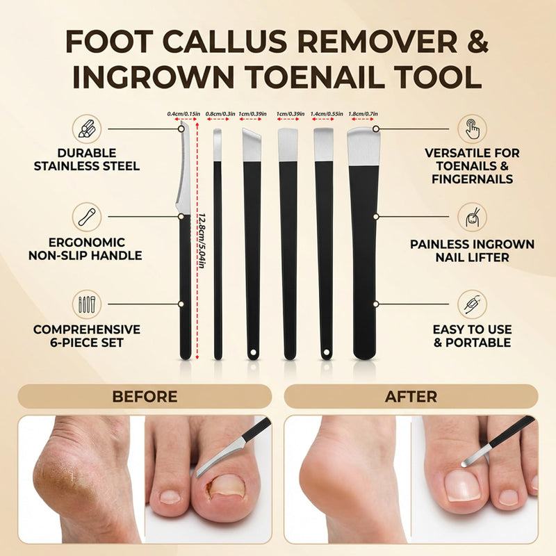 8-Piece Ingrown Toenail Removal Kit & Ingrown Toenail Corrector Tool – Ingrown Toenail Lifter, Ingrown Toenail Tool with Storage Box, in Stainless Steel Pedicure Tools for Paronychia & Dead Skin - BeesActive Australia