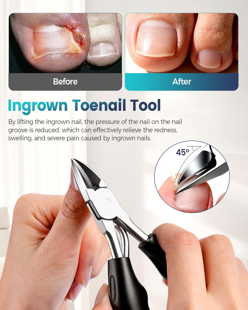 Professional Ingrown Toenail Corrector, 2-in-1 Ingrown Toenail Removal Kit with U-Shaped Strips and Correction Patch, Ingrown Toenail Clippers Tool Set- Effective Removal of Ingrown Toenails (Silver) Silver - BeesActive Australia