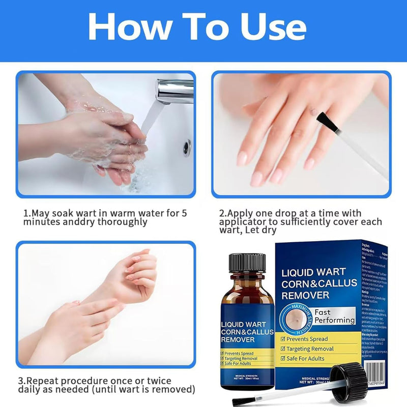 Corn Removers for Toes: Liquid Salicylic Acid Corn Removal for Feet - Corn Callus Remover for Feet Extra Strength (0.5 Fl Oz) 0.5 Fl Oz - BeesActive Australia