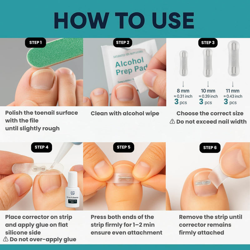 Kids Ingrown Toenail Corrector, Gentle & Safe Ingrown Toenail Treatment for Children, At-Home Solution for Kids Ingrown & Curved Nails, Comfortable Lift for Delicate Nails (0.31 Inch) 0.31 Inch