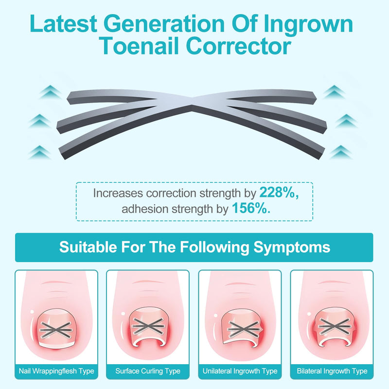 Ingrown Toenail Treatment Kit with Upgraded 6-Angle Shape,Titanium Alloy Ingrown Nail Corrector Tools with 4 Multi-Sizes,Ingrown Toe Nail Relief Remover Strips for Curved Toenail Quick Relief,8Pcs