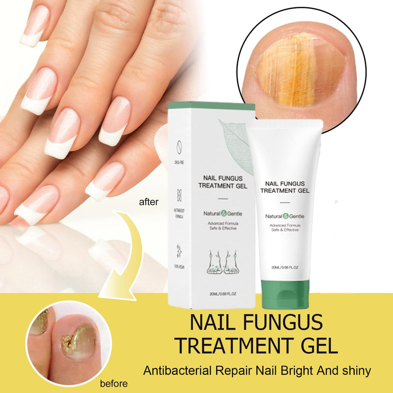 Nail Fungus Treatment Gel, Nail Fungus Treatment Cream,Multi-Purpose Nail Repair Oil Serum (1pcs) 1pcs