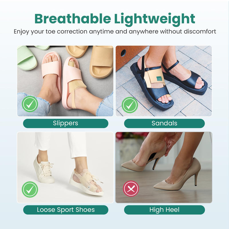 Welnove Bunion Corrector Women & Men Big Toe: 1 Pair Bunion Splint - Adjustable Bunion Correction - Toe Straightener with Non-slip Strap, Day Night Support (Beige) - With 2 Gel Separators