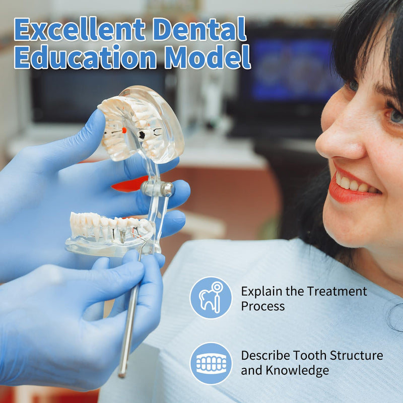 Annhua Transparent Disease Teeth Model for Dental Students, 32 Standard Removable Typodont Teeth Pathological Teaching Model - Ideal for Teaching, Not for Clinical Use Standard-Transparent Teeth Model - BeesActive Australia