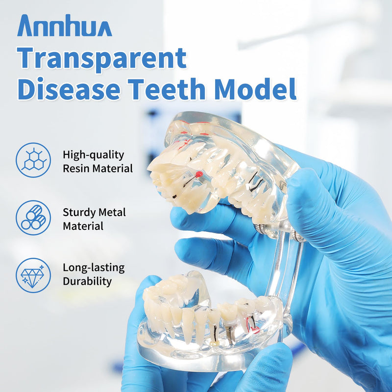 Annhua Transparent Disease Teeth Model for Dental Students, 32 Standard Removable Typodont Teeth Pathological Teaching Model - Ideal for Teaching, Not for Clinical Use Standard-Transparent Teeth Model - BeesActive Australia