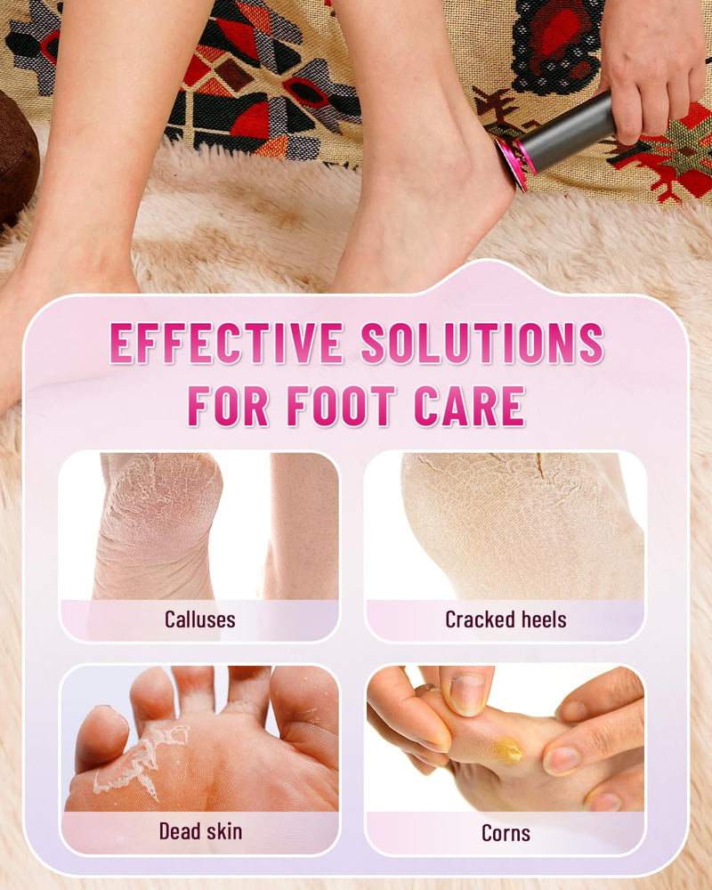 DERMAWAVE Electric Callus Remover for Feet, Professional Electric Foot File Sander Grinder with 60 Sandpaper & Speed Controller for Men & Women – Aluminum Pedicure Tool for Cracked Heel Dead Skin - BeesActive Australia