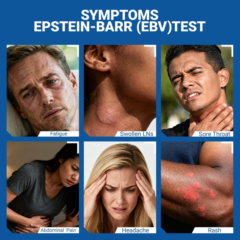 at-Home Epstein-Barr (EBV) Test Kit – Finger-Prick Sample, No Lab Visit Needed – Detects IgG Response to VCA & EBNA (for in Vitro Diagnostic Use Only) 1 Count (Pack of 1) - BeesActive Australia
