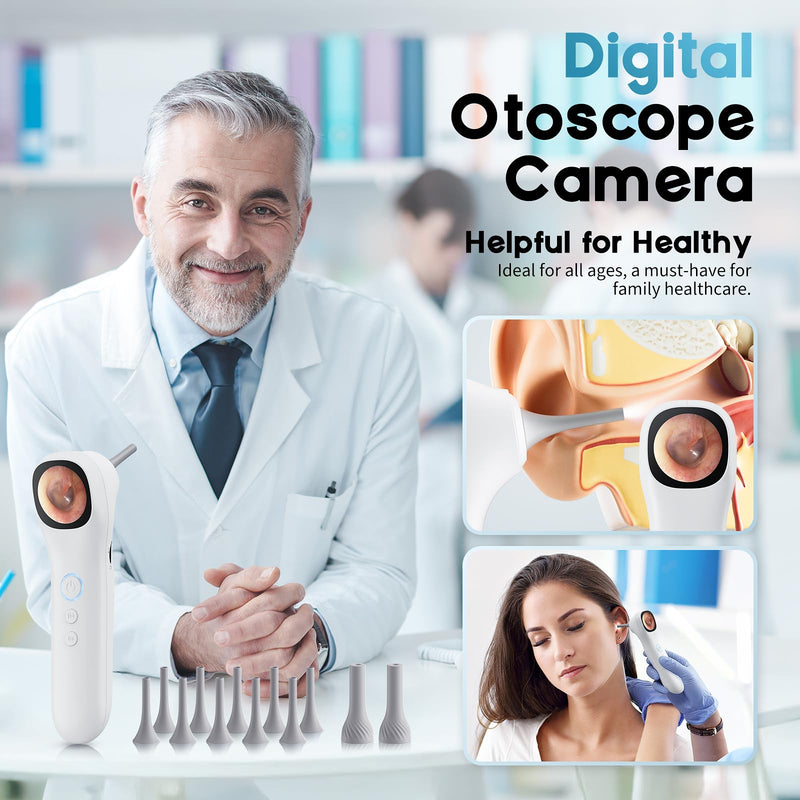 Otoscope Ear Camera with 1.21” Screen, 1080P Ear Scope with 4 LED Lights, Otoscope Camera for Adults Kids, Support Photo & Video, Type-C Charging with Computers, Baby Essentials, Home Medical Simplified – White - BeesActive Australia
