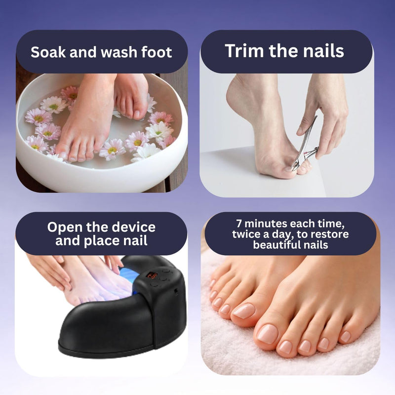 Nail Fungus Blue Light Therapy Device for Toenails & Fingernails, Home Use Toenail Fungus Treatment Device for Onychomycosis