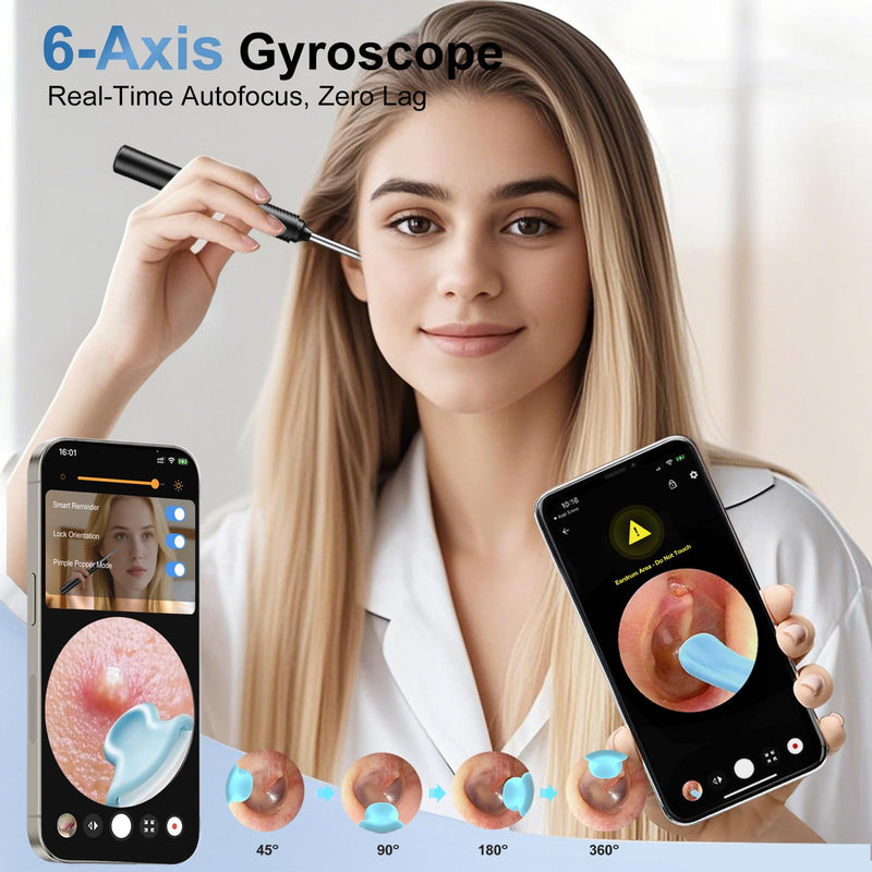 AI Eardrum Alert, AI Ear Wax Removal Kit, 1080P HD Camera with 6-Axis Gyroscope, Waterproof Lens, 230mAh Battery, Earwax Removal Tool with 8 Pcs Ear Set, Otoscope Camera for iOS & Android (Black) - BeesActive Australia