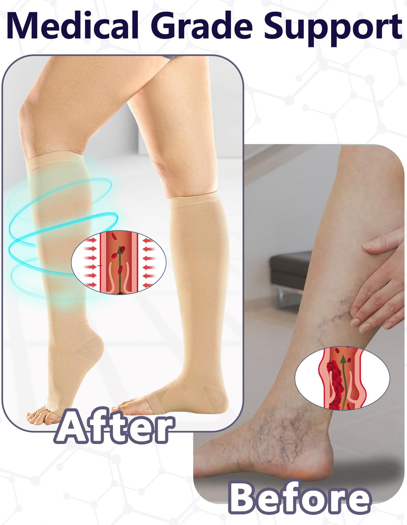+MD 2 Pairs Medical Compression Socks for Women & Men 20-30 mmHg, knee High Open Toe Stocking for Edema, Varicose Veins Medium 2 Pairs Nude - BeesActive Australia