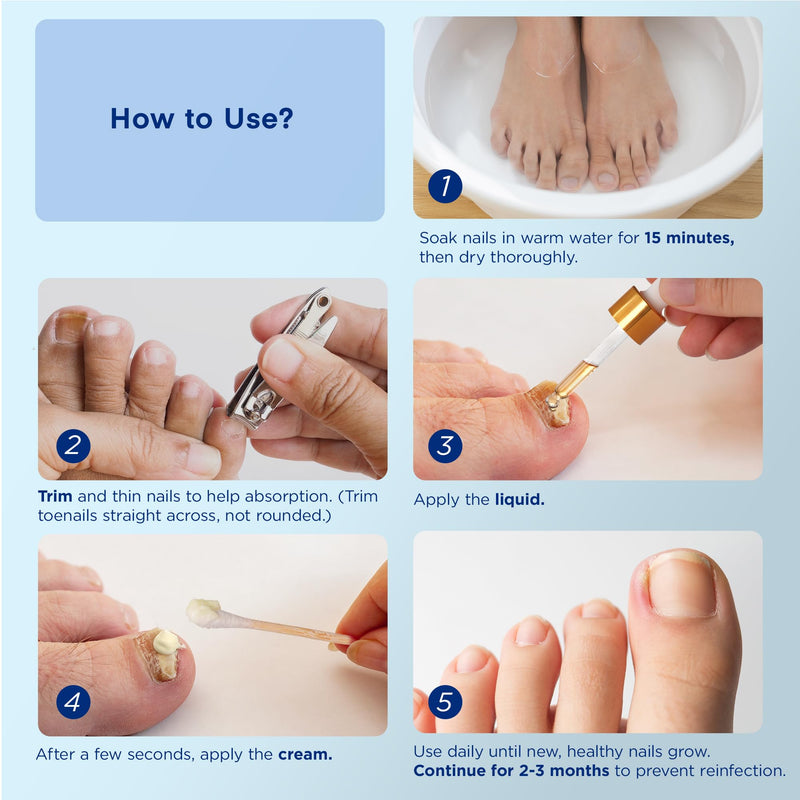 Natural Vine Toenail Fungus Treatment: Fungus Nail Treatment Liquid 15mL and Anti-fungal Nail Repair Cream 20g for Toenail and Fingernails - Extra Strength with Plant Extract Ingredients