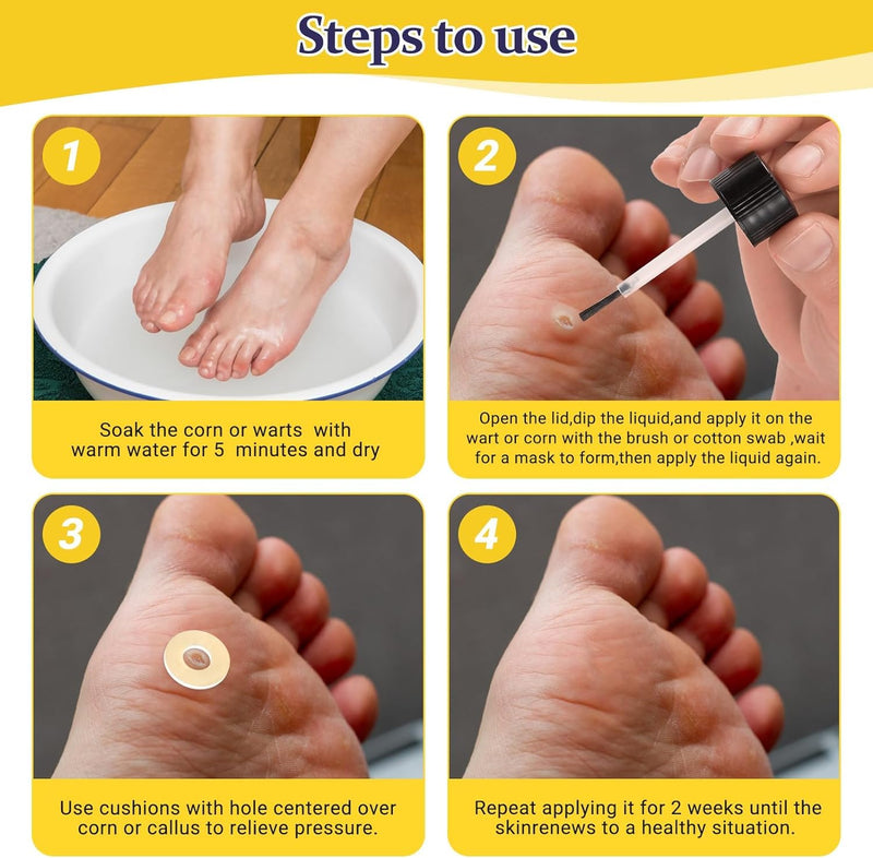Wart & Corn Remover Liquid with Salicylic Acid, Fast Acting Wart Removal for Plantar Wart, Flat Wart, Common Wart, Corn, Callus
