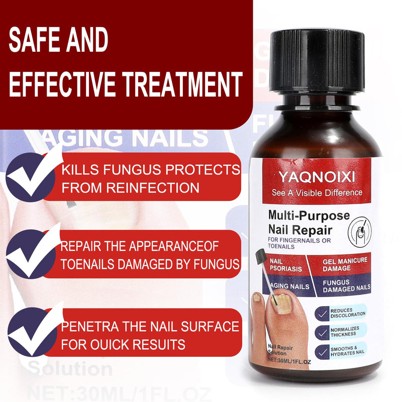 Toenail Fungus Treatment - Fast Acting For Thick, Discolored, Broken & Damaged Toe & Finger Nail, Treats Damaged Nails and Ingrown Toenails - 30ml/1oz (1pcs) 1pcs
