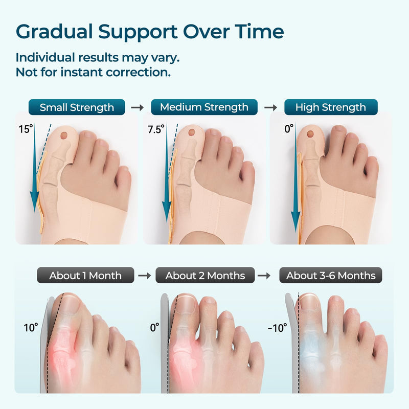 Day & Night Bunion Corrector Set, Walkable Soft Sleeve for Daytime + Structured Night Splint for Sleeping, Big Toe Alignment Support, Men & Women, 2 Pairs M - BeesActive Australia