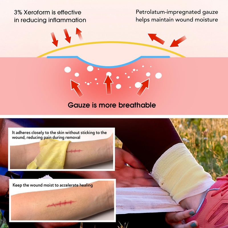 Xeroform Petrolatum Dressing 5"x9", 25 PCS Non-Adherent Gauze for Low Exudating Wounds, Fine Mesh Gauze Pads for Burns, Abrasions, Lacerations, Skin Grafts and Surgical Incisions 5" x 9" (Pack of 25)