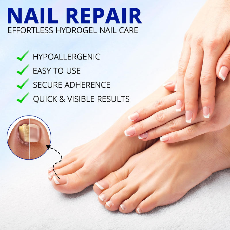 Fungal Nail Patches-Toenail Fungus Treatment Extra Strength, Toe Nail Fungus Treatments, Overnight Hydrogel Nail Care Patches, Nail Repair, Easy To Apply, 42Pcs, For Men & Women,HUIzhijia2pack - BeesActive Australia