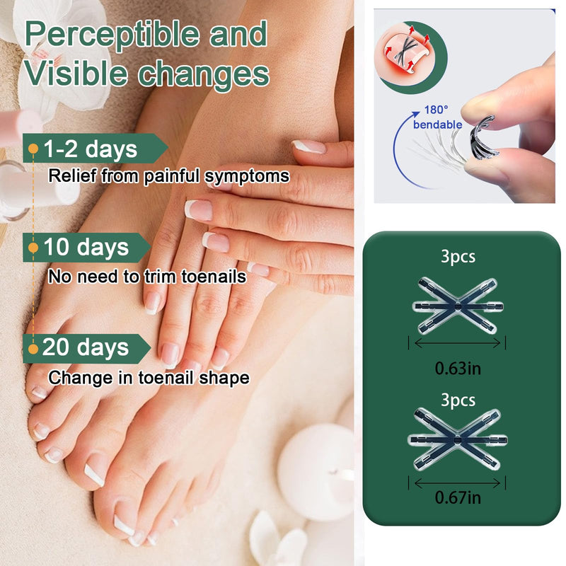 Titanium Alloy Ingrown Toenail Treatment 3X Stronger Pulling Force, Nail Tools and Ingrown Toenail Repair Kit for Curved & Thick Nails, Professional Foot Care Solution for Men & Women (0.63/0.67 in) 0.63-0.67in - BeesActive Australia