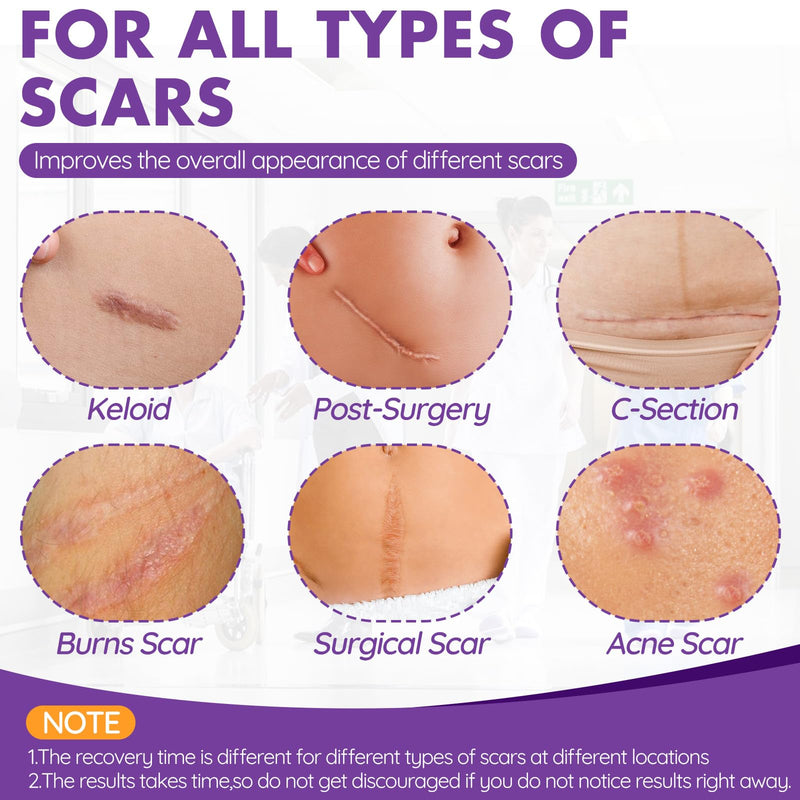 Silicone Scar Sheets, Silicone Scar Tape, Reusable Professional Scar Silicone Strips, Soft Silicone Scar Sheets for Surgical Scars,Keloid,Acne Scars,Burn Scar,C-Section (5M) 5M - BeesActive Australia
