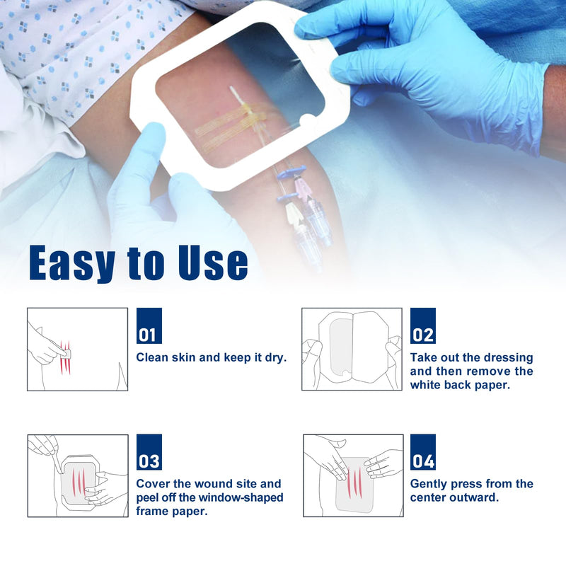 Transparent Film Dressing 6'' x 8'', 20 Packs Waterproof Wound Bandage Adhesive Patches, Wound Cover Patches for Post Surgical Shower, IV Shield, Tattoo Aftercare Bandage 6"x 8"(20 PCS) - BeesActive Australia