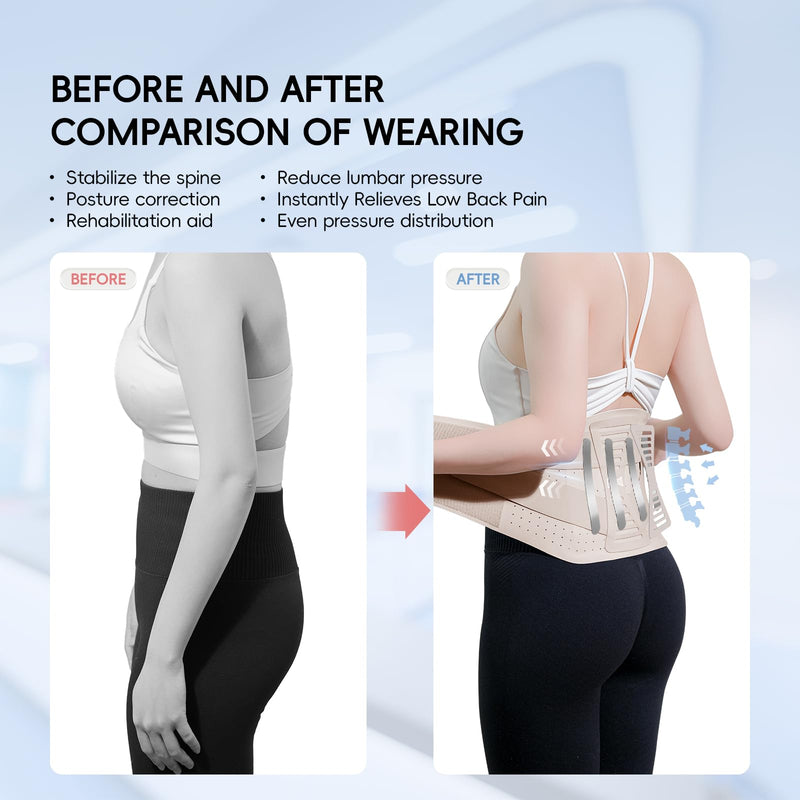GOUNOD Adjustable Back Brace for Lower Back Pain for Women and Men, Removable Stays Back Support Brace for Herniated Disc, Scoliosis, and Sciatica Pain Relief - Ergonomic Design(Beige/M) Beige Medium