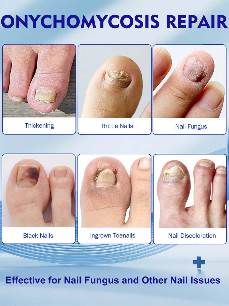 Nail Patches Toenail Treatment Extra Strength 8-Hour Overnight Nail Fast Acting Repair Effortless Hydrogel Nail Care and Repair for Damaged Nails Overnight Renewal for Men and Women (24, Medium)