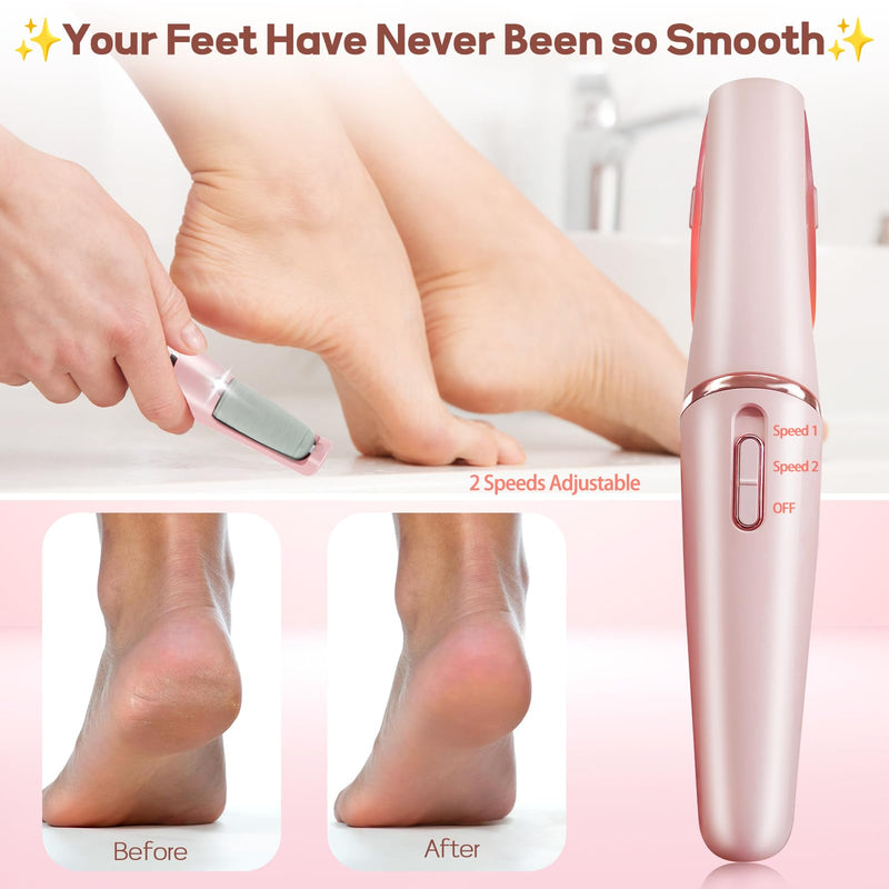 Callus Remover for Feet, ZABOUL Electric Foot Callus Remover Rechargeable Pedicure Tools Smooth Pedicure Wand Electronic Foot File, Feet Care for Removes Dry Hard & Dead Skin Ideal Gift Pink 1 - BeesActive Australia