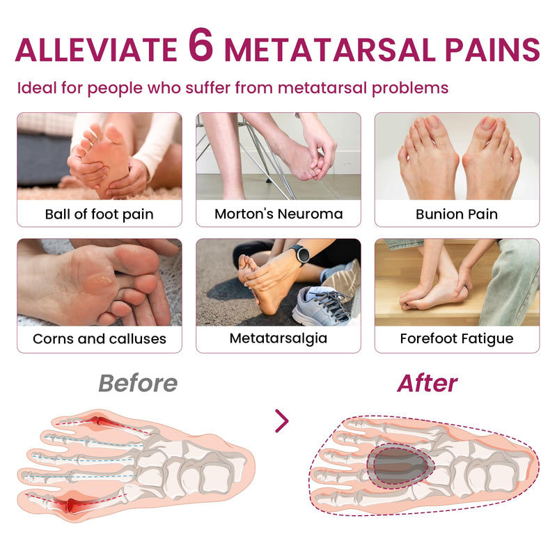 Cloud Feeling Metatarsal Pads for Pain Relief - Bukihome 6-Pair Ball-of-Foot Cushions Forefoot Support Fatigue Relief, Ball-of-Foot Pads for Metatarsalgia Morton’s Neuroma, Men Women Gray