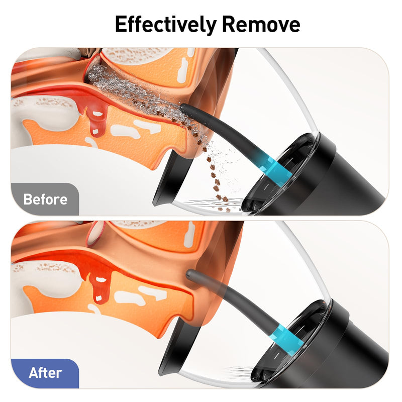 Ear Wax Removal, Retractable Ear Cleaner with 4 Pressure Modes, IPX6, Electric and Water Resistant Ear Wax Removal Kit, Rechargeable Ear Cleaning Tool with USB, Ear Washer for Humans In-home