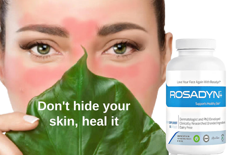 Rosacea Skin Care Supplement for Redness of Face, Eye and Nose | Targets the Root Cause of Symptoms