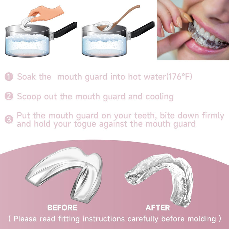 4 Pack Pink Kids Mouth Guard for Grinding Teeth, Moldable Kid Mouth Guard for Clenching Teeth at Night, Comfortable Mouthguard Stops Bruxism, TMJ Small Size for Kids - BeesActive Australia