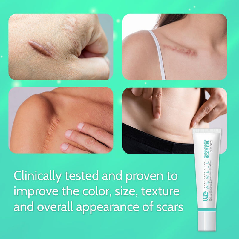 Scar Cream for Keloid Bump Removal: Professional Silicone Gel for Keloids, Acne Scars, Stretch Marks, C-Section & Burn Marks – Old & New Scar Care Treatment, 1 oz 30g (Pack of 1)