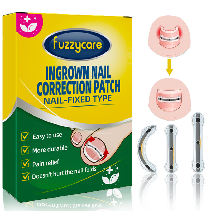 Ingrown Toenail Treatment Kit, Titanium Alloy Ingrown Toenail Removal Kit, Nails Corrector Tool & Remover Strips - Ingrown Toe Nail Quick Relief 10 Count (Pack of 1)
