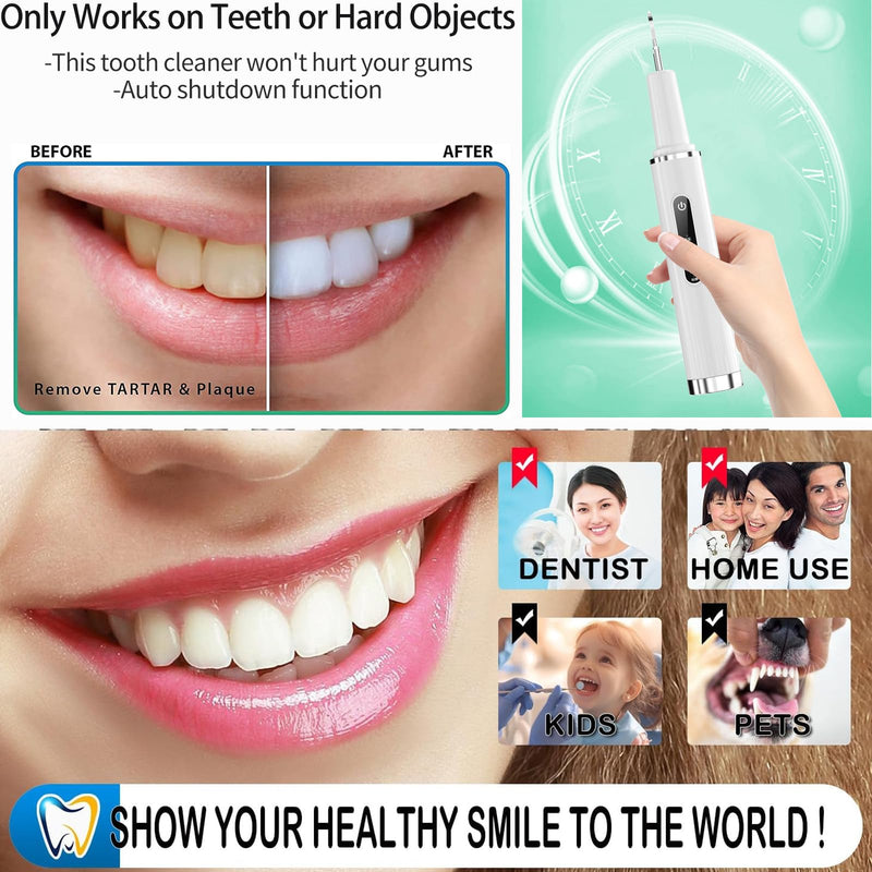 Professional Plaque Remover for Teeth, Teeth Cleaner Tool with Intelligent and Secure Sensor Technology, 4 Replaceable Heads 5 Modes, OLED Light & Oral Mirror, Rechargeable Teeth Cleaning Kit For Home - BeesActive Australia