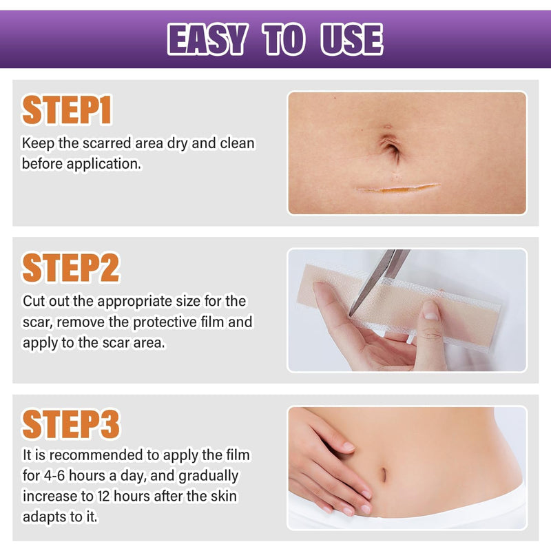 Silicone Scar Sheets,Silicone Scar Tape,Silicone Scar Removal Strips for Surgical,C-Section,Tummy Tuck,Keloid Scars (1.6"X 59" Roll-1.5M) Keloid Bump Removal 1.5M - BeesActive Australia