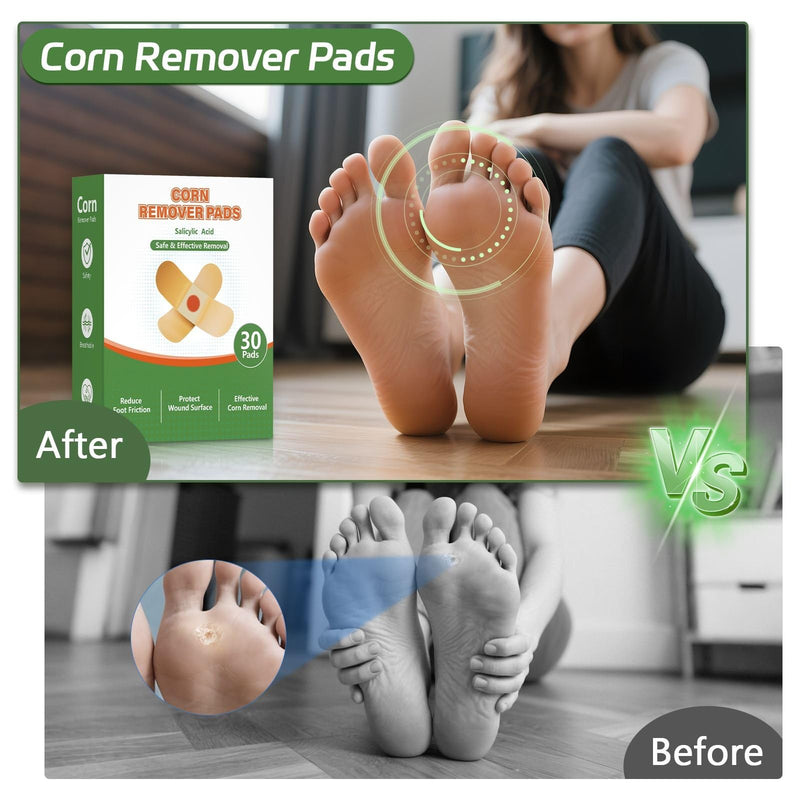 Corn Removers Pads for Feet & Toes - 40% Salicylic Acid Extra Strength Treatment, Maximum Adhesive Medicated Patches with All Day Protection - 30 Count 30 Count (Pack of 1) - BeesActive Australia