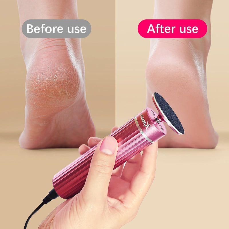 5.3'' Electric Foot Callus Remover with 80pcs Sandpaper Discs & Brush, Professional Aluminum Ergonomic Pedicure Tool, Stepless Speed & Reverse Control for Dead Skin Removal (Pink) Pink - BeesActive Australia