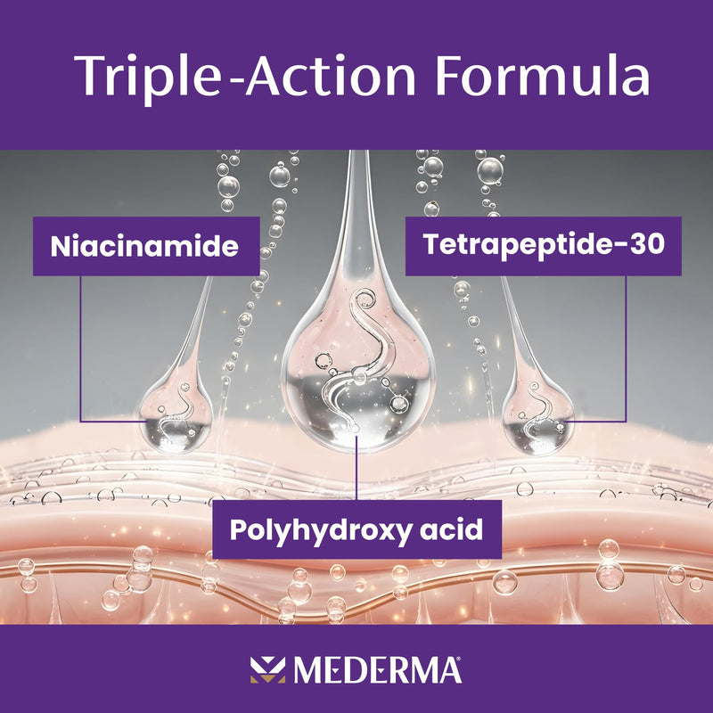 Mederma Acne Scar Serum Triple-Action Formula with Niacinamide, Tetrapeptide-30, and Polyhydroxy acid Clinically Shown to Lighten Acne Scars, 1 Fl. Oz.